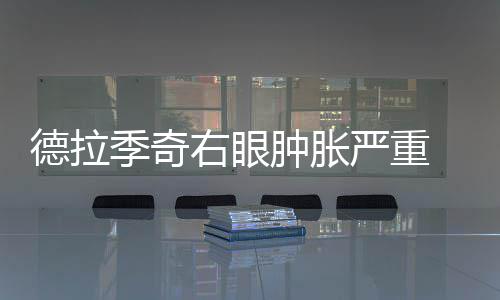 郑东新区为雨污水井装防坠网 承载力达200公斤 热火输球的像洛热火队