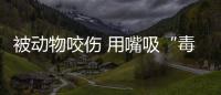 被动物咬伤 用嘴吸“毒”可不中