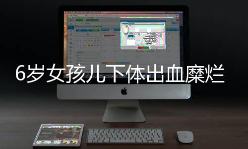 河南省直机关公车本周日拍卖 最低价仅1000元 笔帽塞进了“小洞洞”里